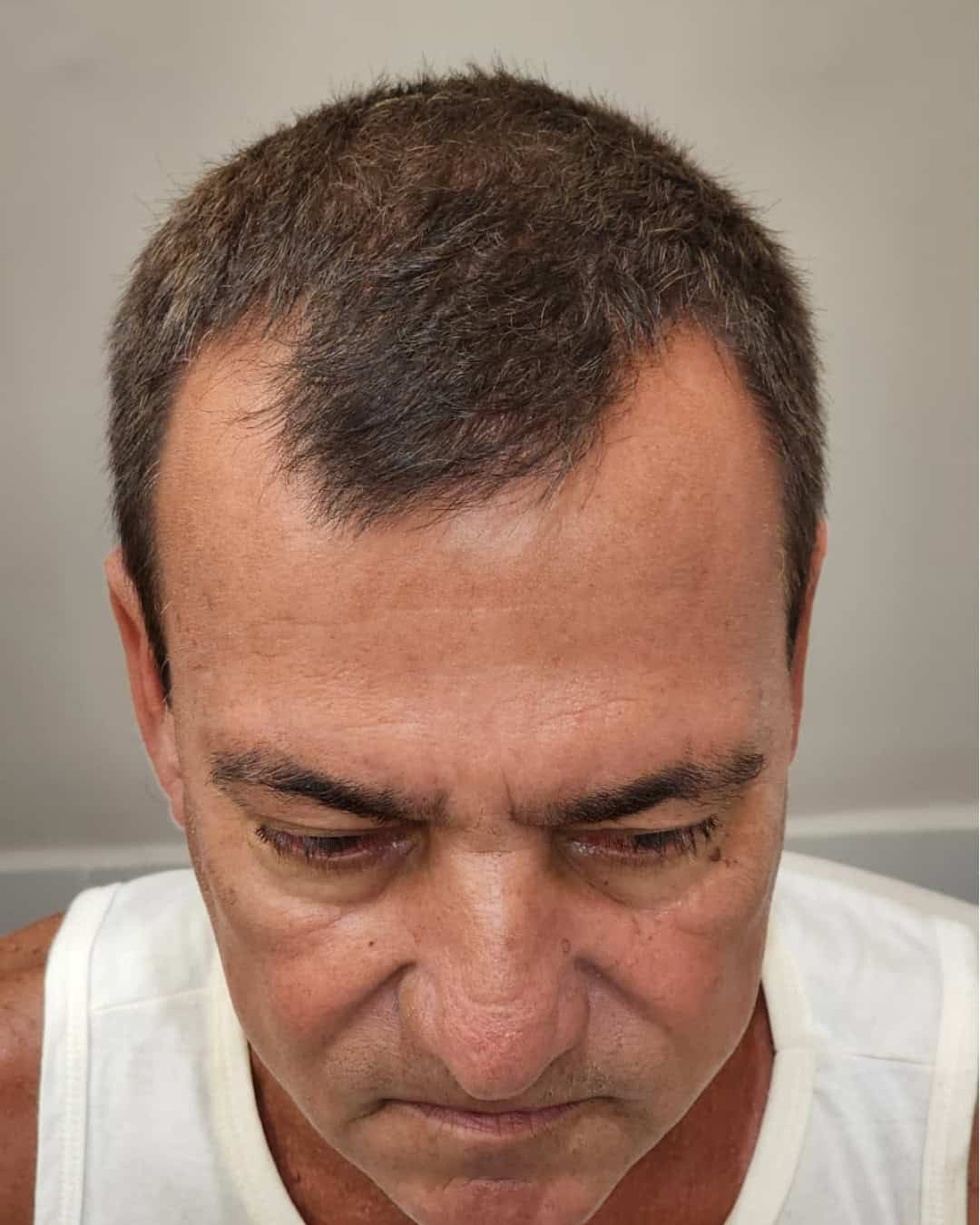 Antes