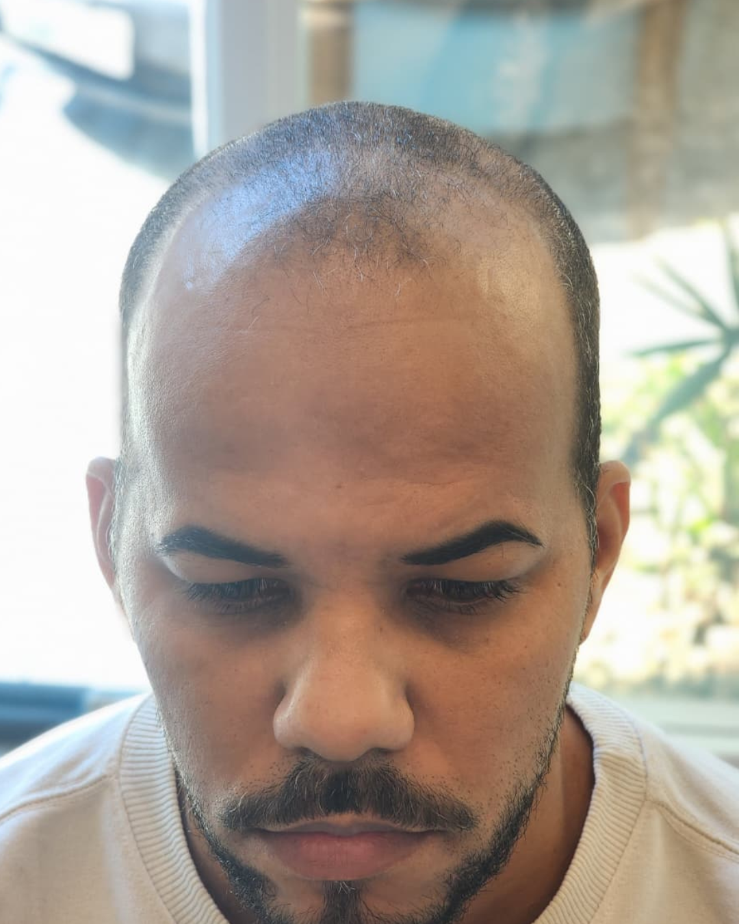 Antes